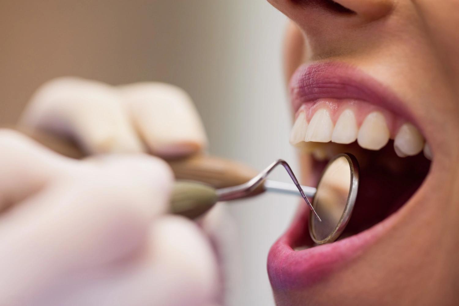 Odontologia popular: o que é, como funciona e os tratamentos acessíveis